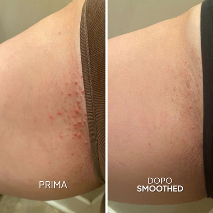 Smoothing Solution - Trattamento Contro i Peli Incarniti